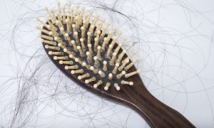 Read more about the article Θεραπεία για την απώλεια μαλλιών(video)